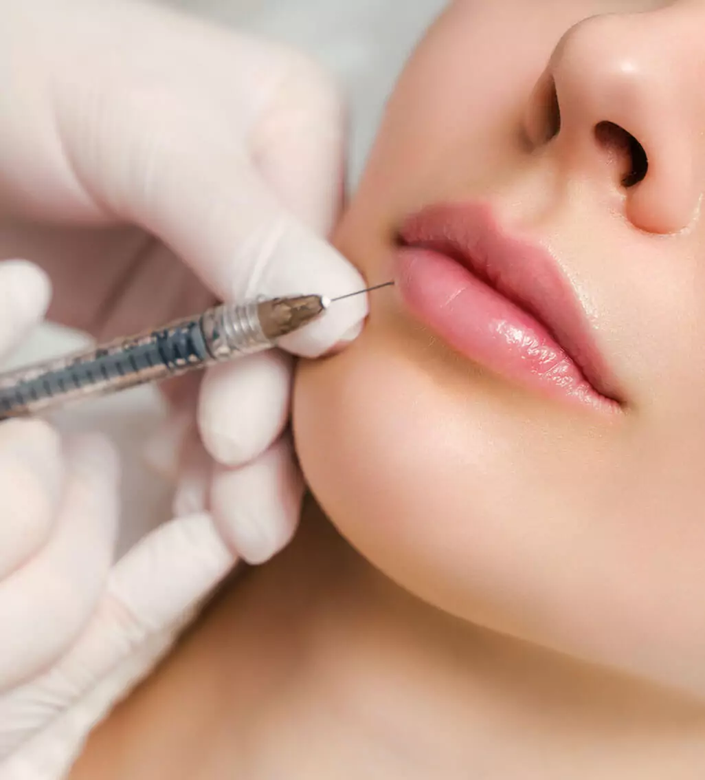 Lippenaugmentation Füllung Pera Medical